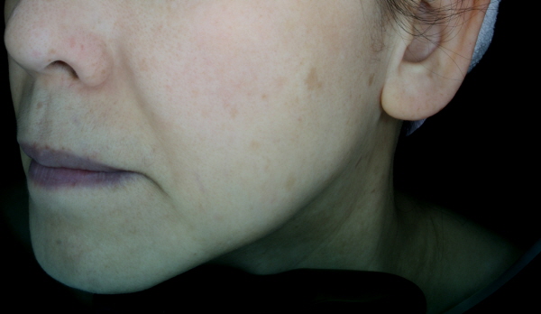 After Photo